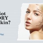 Do you have Dry Skin?
