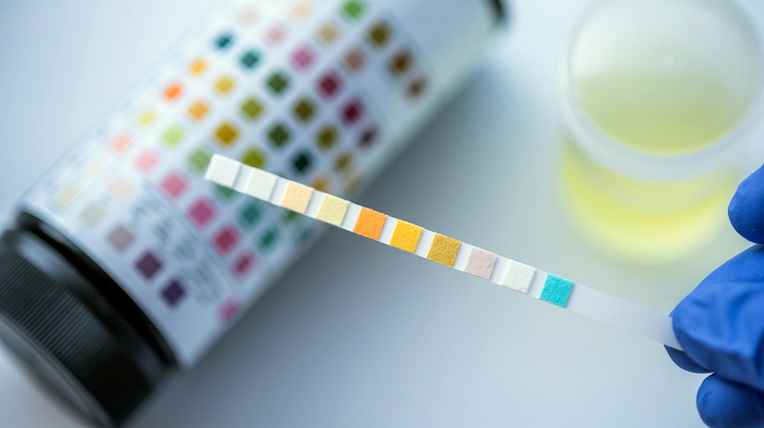 Alkaline Water And Urine